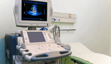 Modern ultrasound machine with control panel and imaging screen in a clinical setting